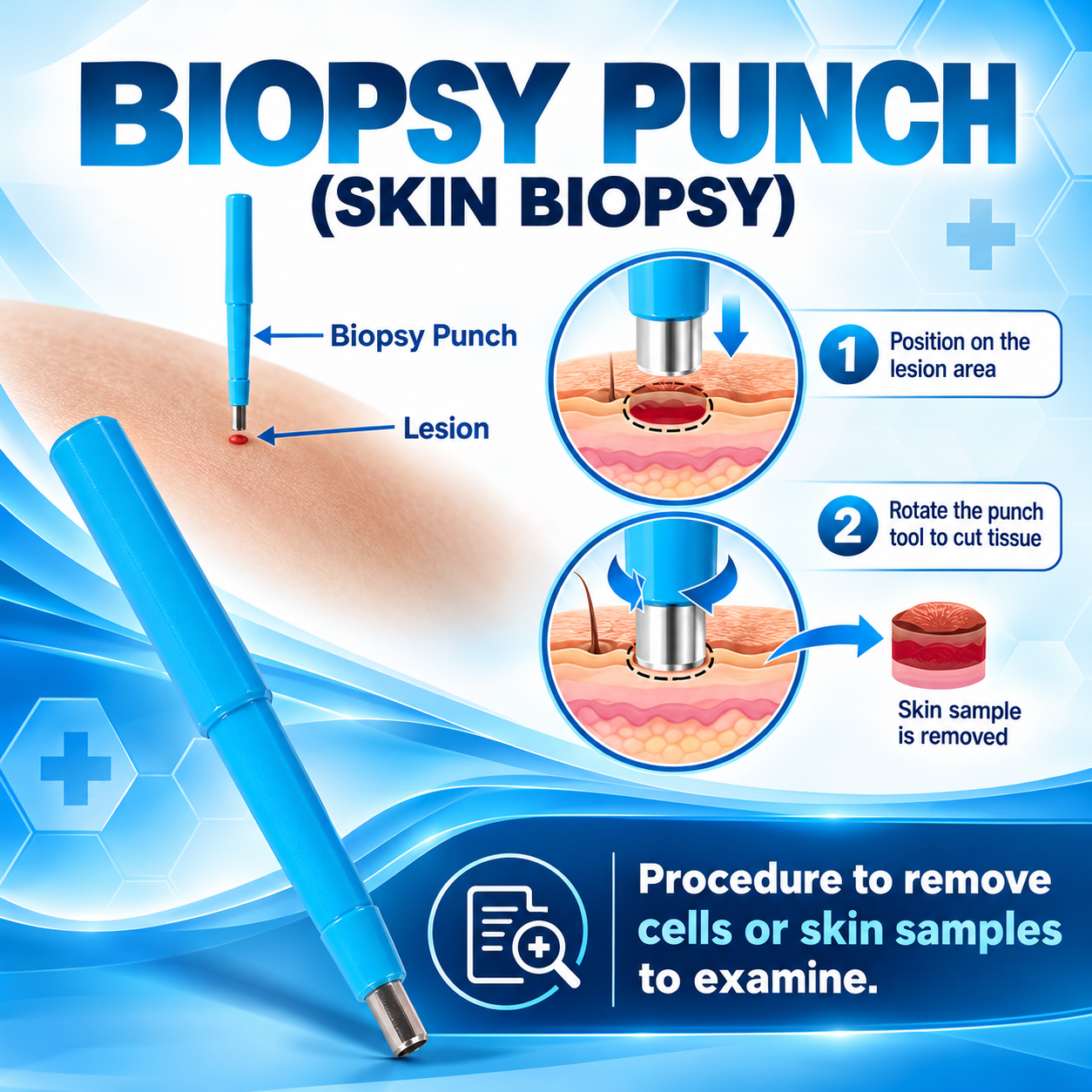 Disposable Biopsy Punch (Pack of 100) | Stainless Steel Disposable Skin Biopsy Punch | Precision Dermatology Surgical Instrument for Clinical & Hospital Use Individually Packed - Sterile (4.0MM) - Image 5